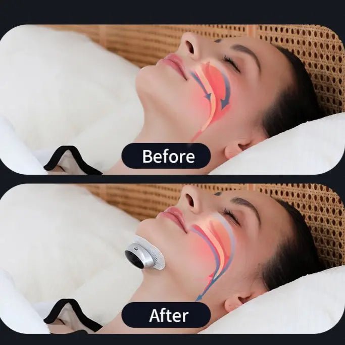 Say Goodbye to Sleepless Nights: The Ultimate Anti-Snoring Solution